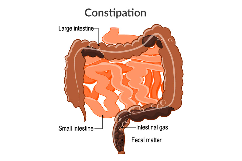 BYE-BYE constipation